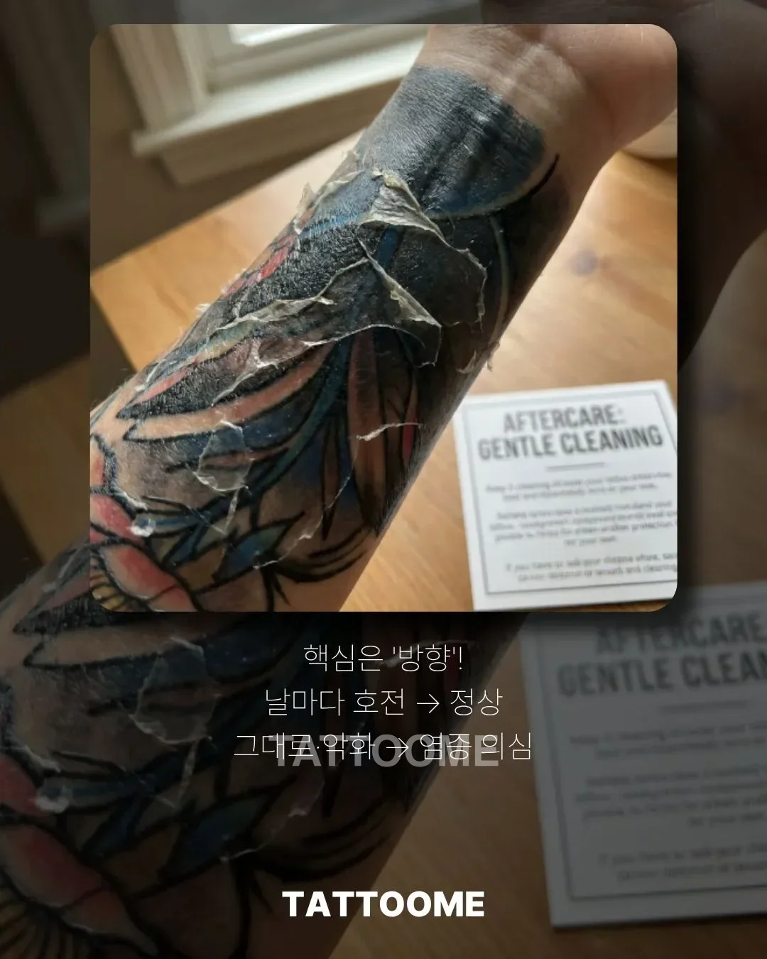 정상 회복과 타투 염증 비교