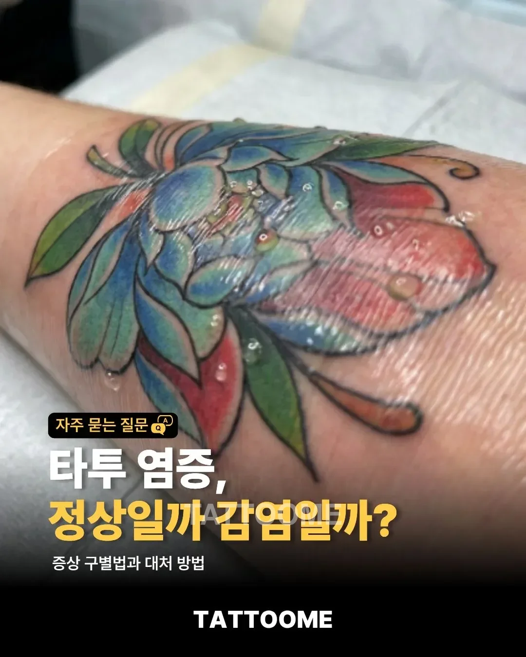 타투 염증과 정상 회복을 설명하는 대표 이미지
