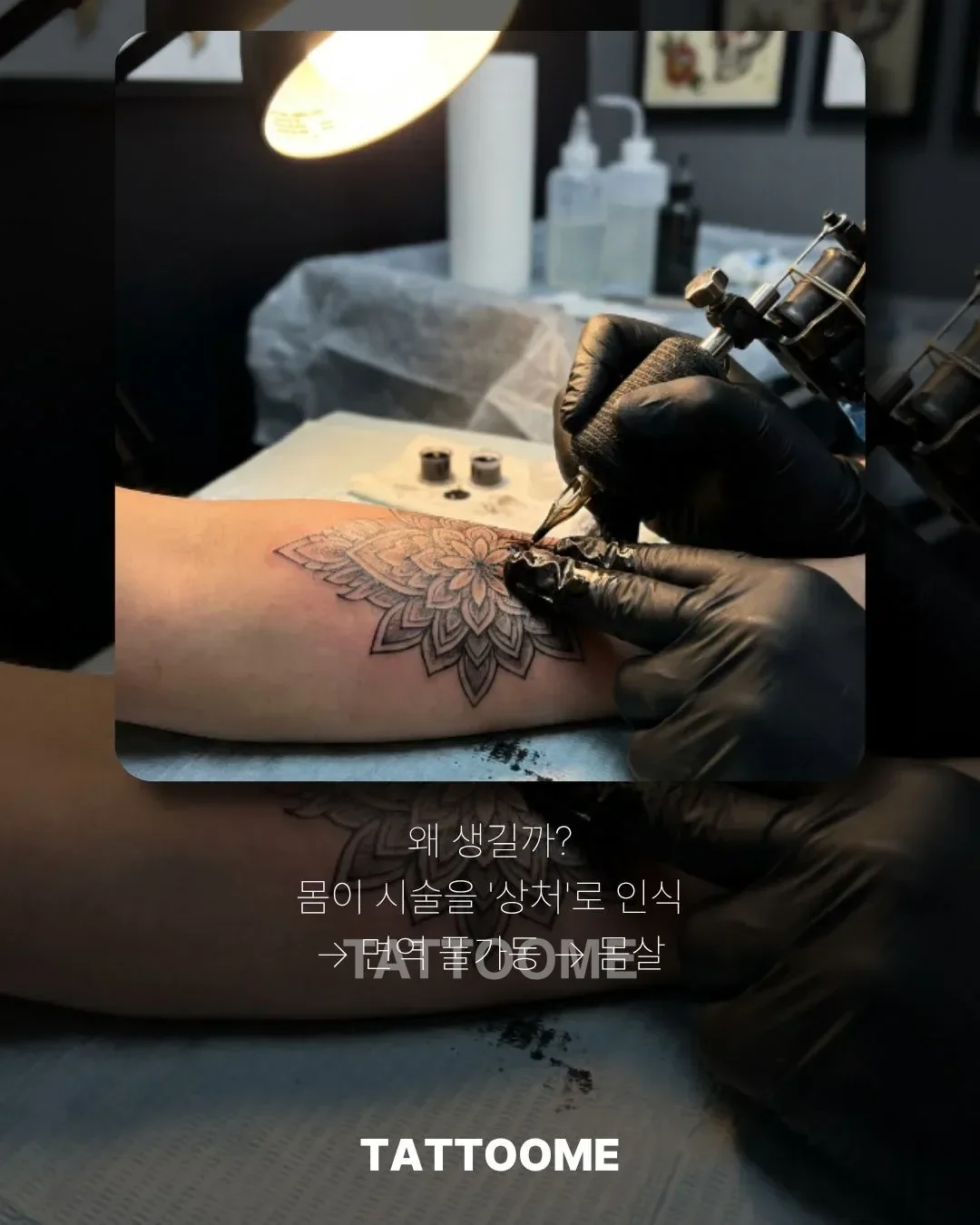 타투 몸살이 생기는 원인