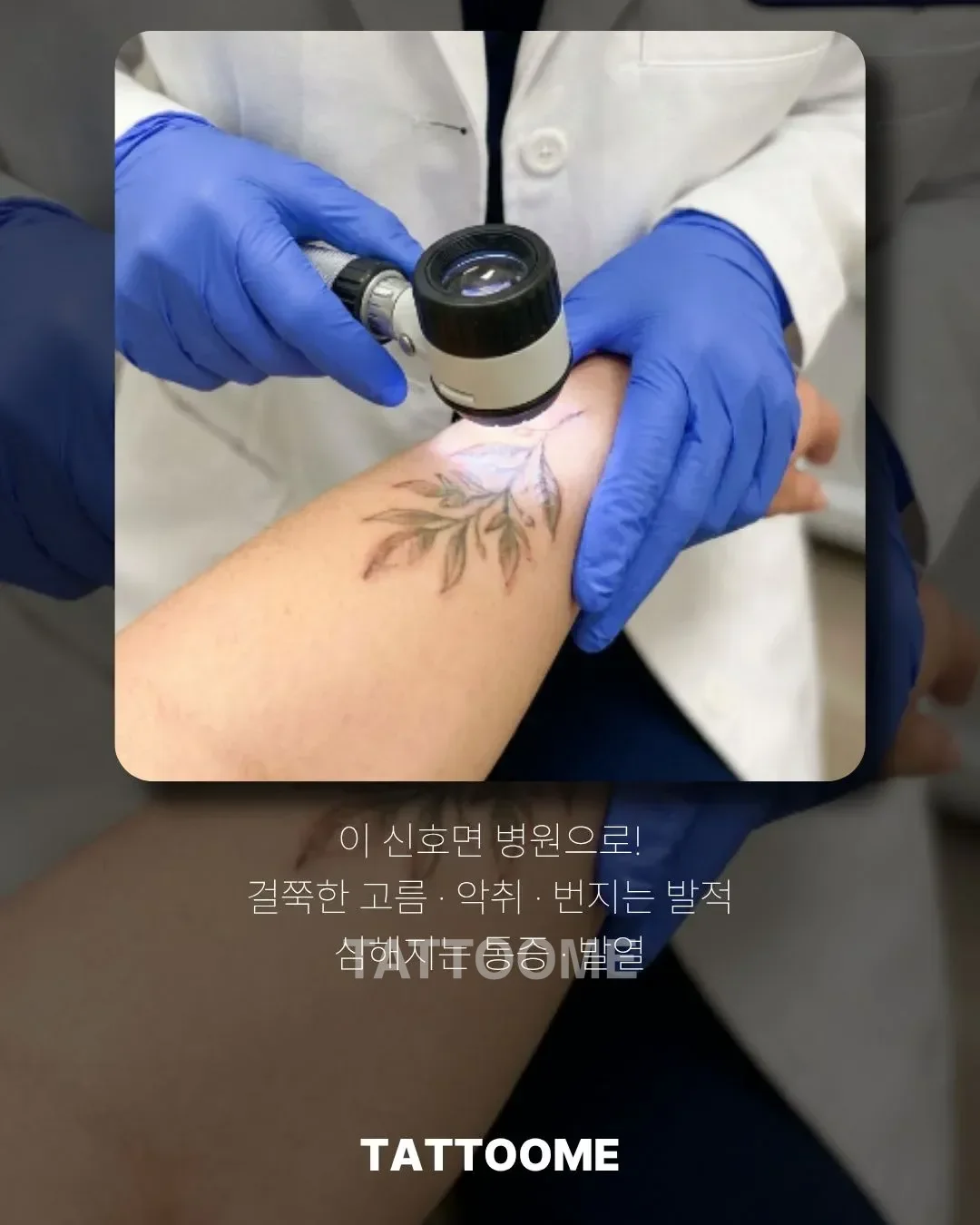 타투 감염 신호와 병원 진료