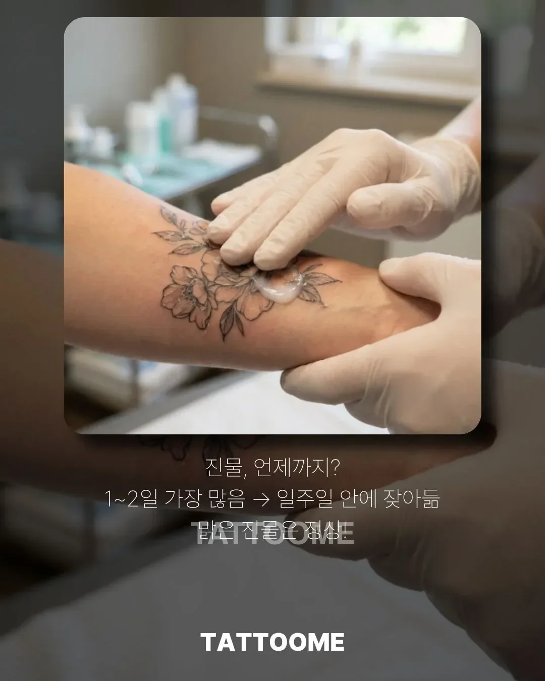 타투 진물이 나는 초기 회복 단계